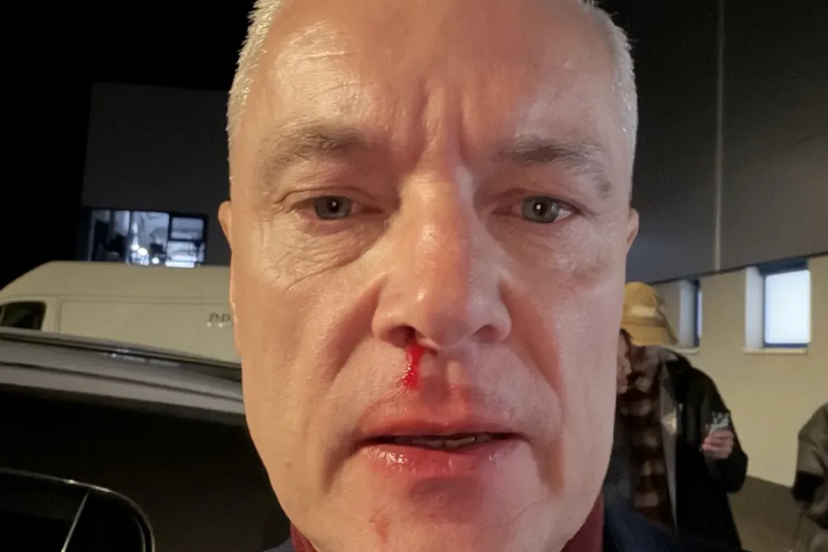 Primátor Kežmarku Ján Ferenčák po nočnom útoku vypovedal. Na políciu prišiel v doprovode právnika