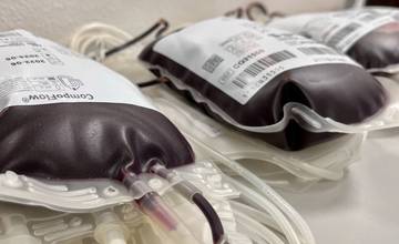 Počas leta daruje krv málokto. Pomôžte zachraňovať životy odberom v levočskej nemocnici