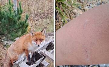 Turistku pri Rainerovej chate pohrýzla do nohy líška, chcela od nej získať jedlo