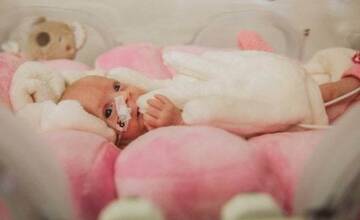 OZ Malíček reaguje na ministerku Dolinkovú s predčasniatkom v náručí