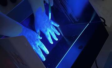 Výskyt žltačky v Prešovskom kraji sa rozšíril o ďalšie okresy