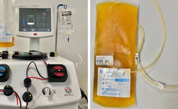 Levočská nemocnica začala na Valentína odoberať krvnú plazmu. Prví dobrovoľníci to majú úspešne za sebou