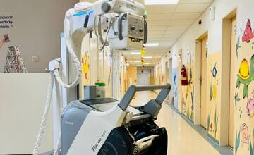 Kežmarská nemocnica využíva prenosný RTG prístroj. Vyšetriť pacientov tak môžu aj mimo oddelenia