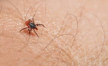 Kliešť dokáže spôsobiť vážne zdravotné problémy. Ako sa pred ním efektívne chrániť?