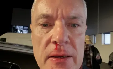 Ján Ferenčák po nočnom útoku vypovedal. Výbor pre nezlučiteľnosť funkcií začal konanie za neúplné majetkové priznanie