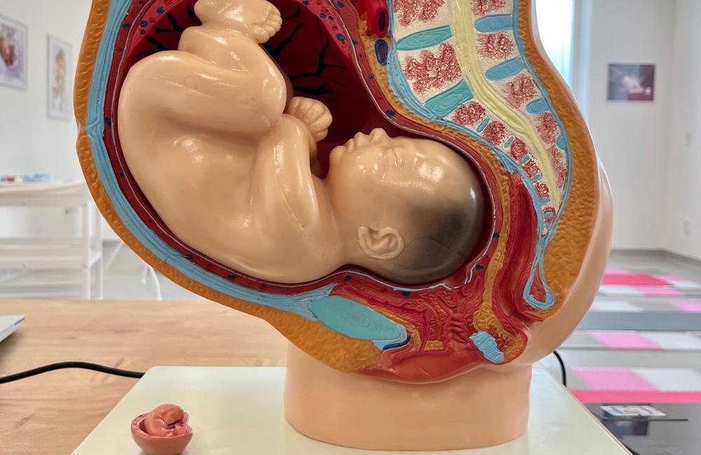 FOTO: Nemocnica v Kežmarku otvorila centrum predpôrodnej prípravy. Rodičky sa naučia viac o pôrode či šestonedelí, foto 8