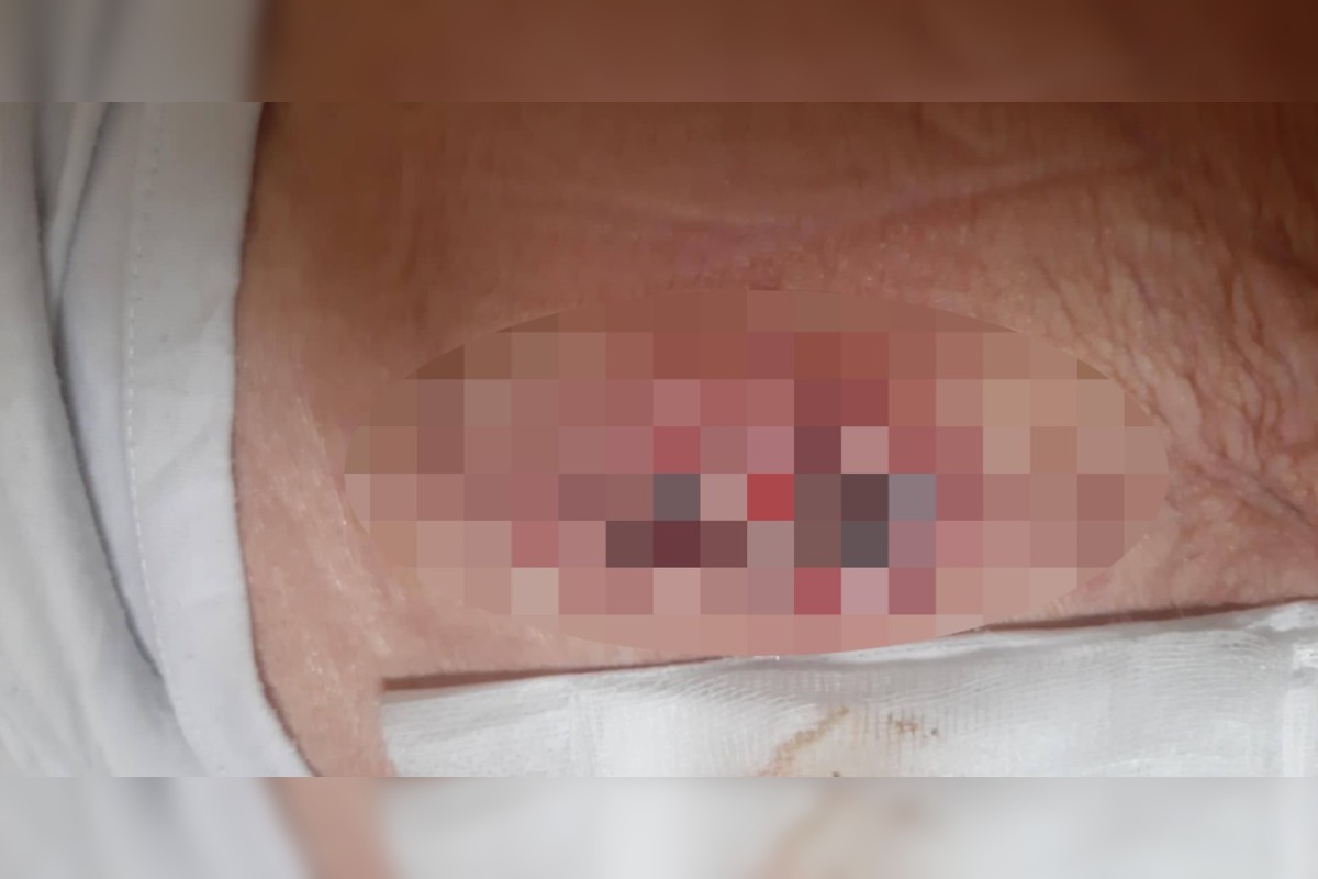 FOTO: Vnučka hovorí o zlej starostlivosti o babku, foto 1