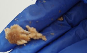 FOTO: Popradčanka našla železo v jedle. Pasca na psy? Hrozí aj deťom