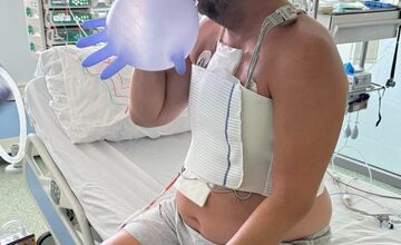 FOTO: Minister Migaľ skončil na operačnom stole dvakrát za sebou