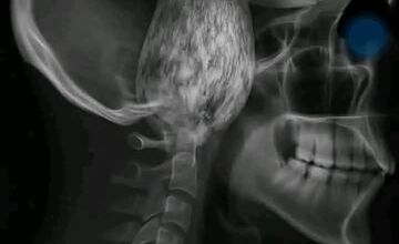 FOTO: Hubárska diagnóza zasiahla východ. Dubáky, smiech aj plné košíky